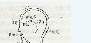 73172051_1
